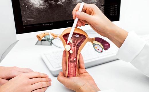 How Endometrial Polyps Impact Fertility and IVF Success